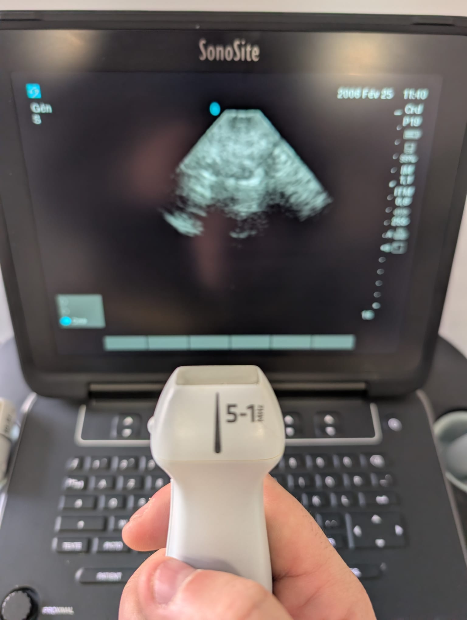Sonosite RP19x - Imagen 3