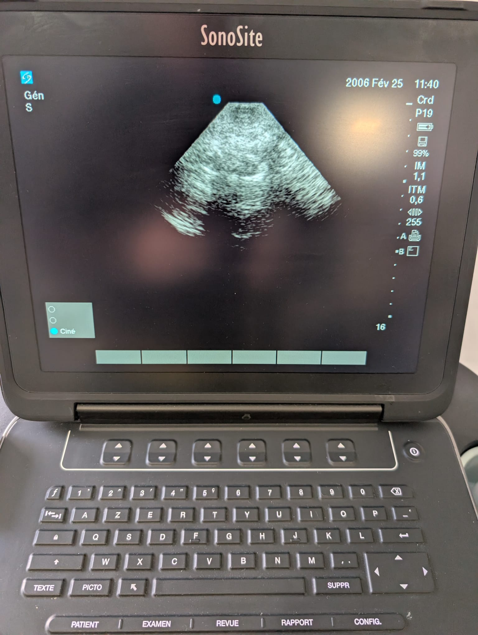 Sonosite RP19x - Imagen 4