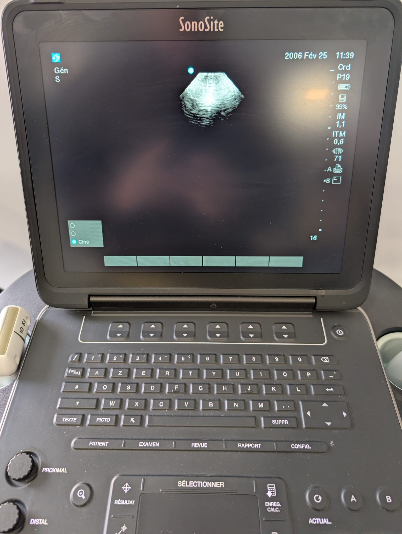 Sonosite RP19x - Imagen 5