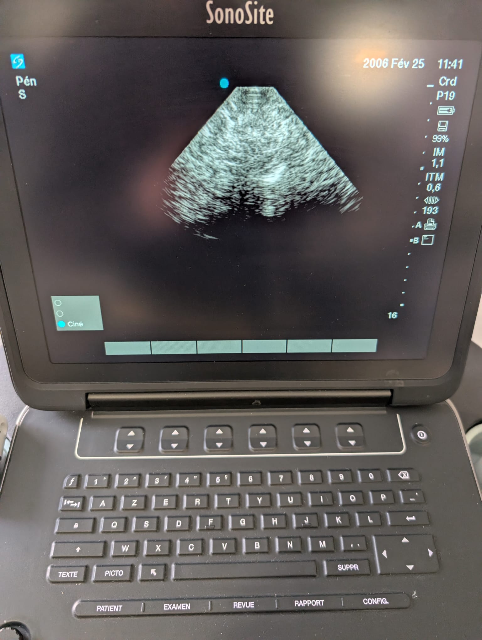 Sonosite RP19x - Imagen 6