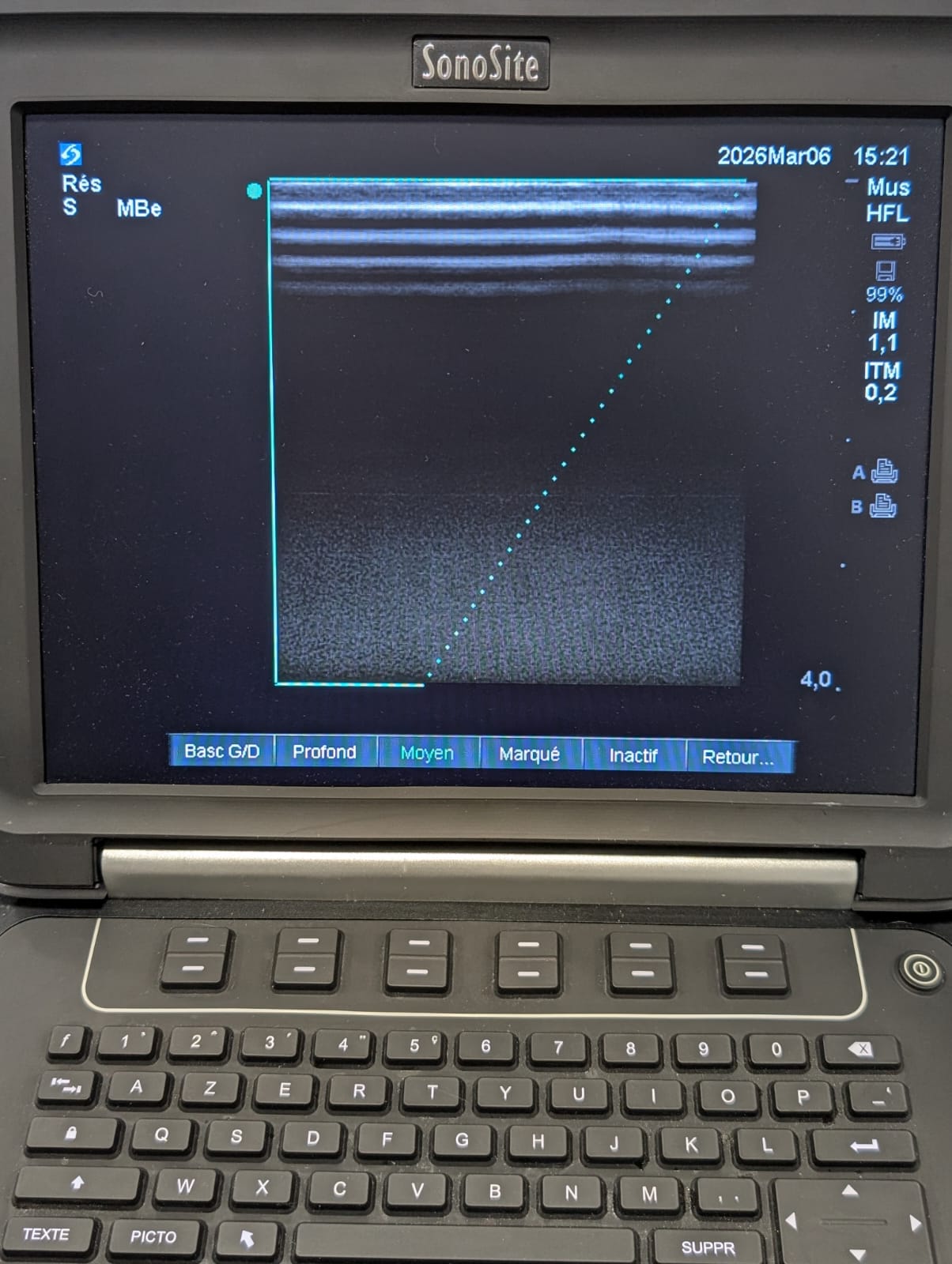Ecógrafo Sonosite Edge - Imagen 11