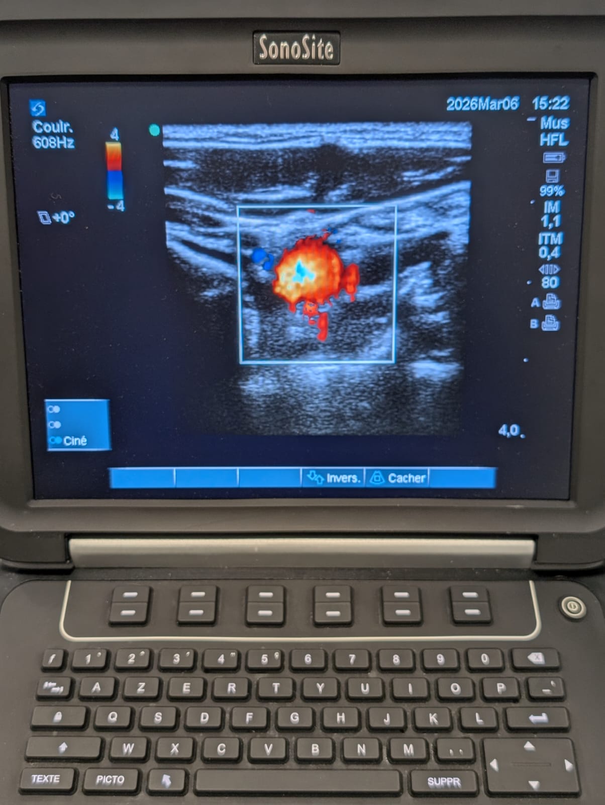 Ecógrafo Sonosite Edge - Imagen 12